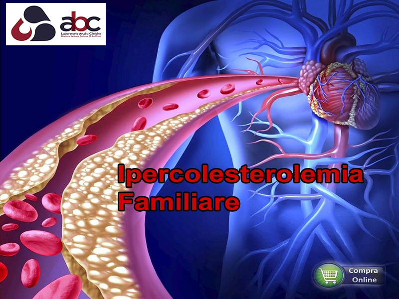 ipercolesterolemia familiare