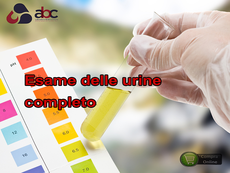 urine completo